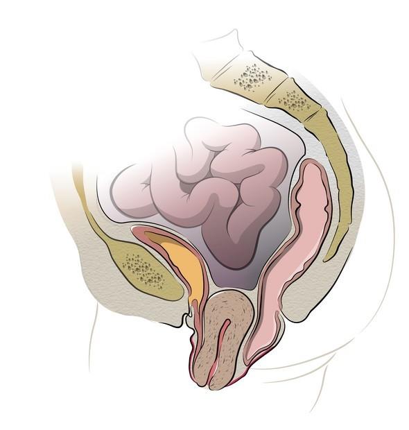 Uterine or Vaginal Vault Prolapse – Chicago Urogynecology